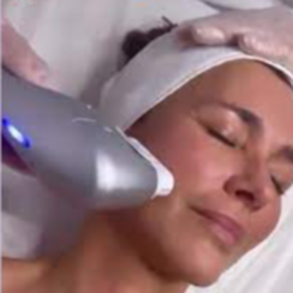 MEMBRESÍA FACIAL