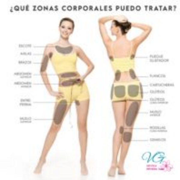 HIFU Abdomen y cintura