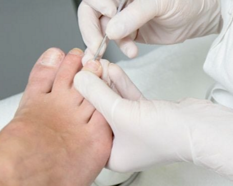 Pedicuria completa (con o sin bisturi) 