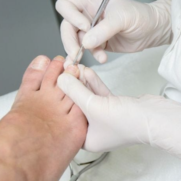 Pedicuria completa (con o sin bisturi) 