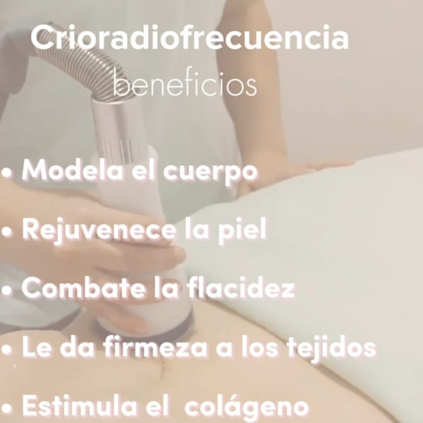 CRIORADIOFRECUENCIA X 4 ZONAS