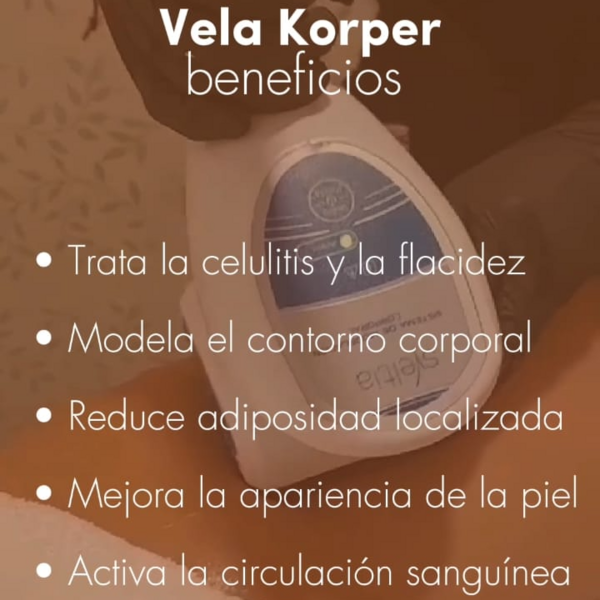 VELA Y CRIORADIO
