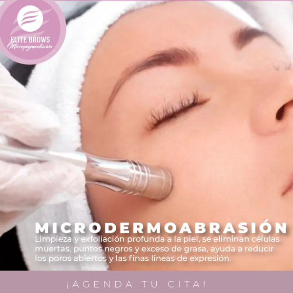 Microdermoabrasion
