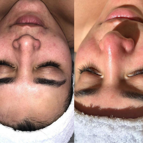 Special Skin Care