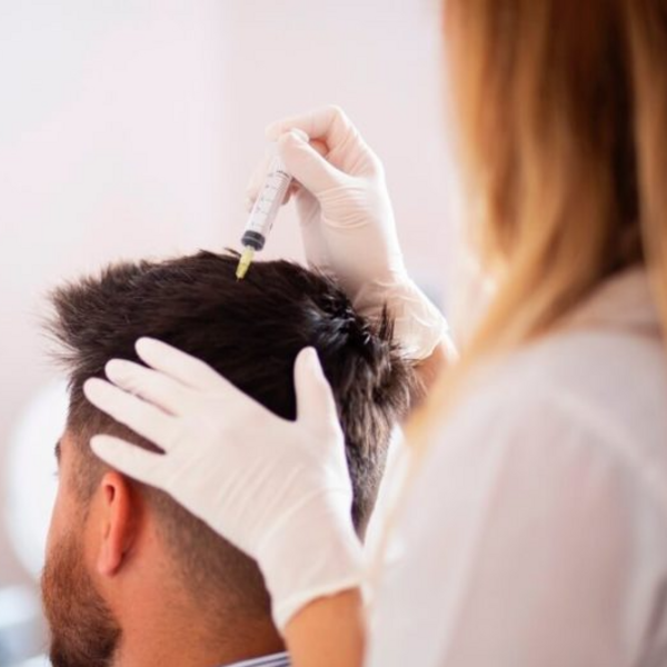 Mesoterapia Capilar