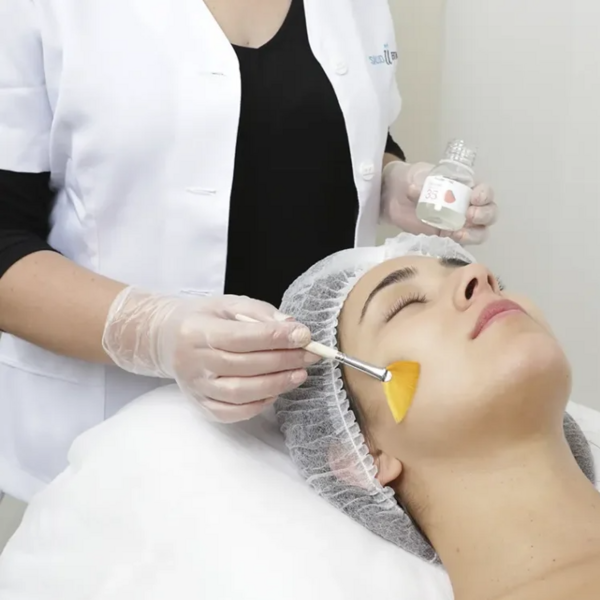 Peeling Facial Médico