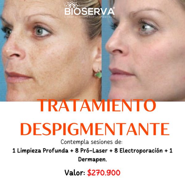 Tratamiento Despigmentante  (1LP+8ProLáser+8EP+1Derm) 9 Sesiones 