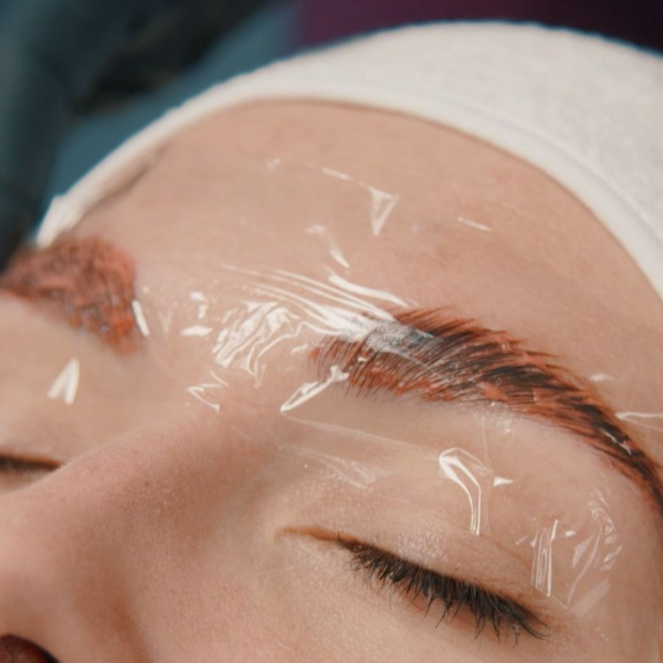 Fijación de Cejas 
