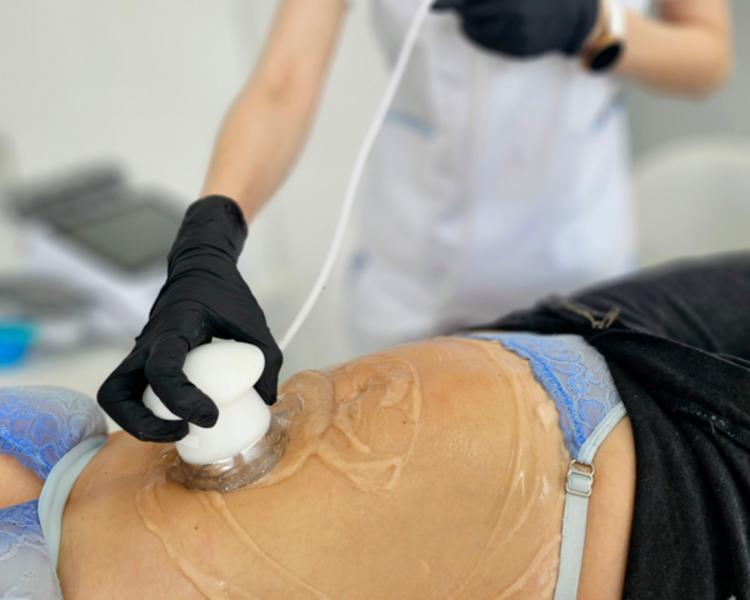 ELECTRODOS+RADIOFRECUENCIA CORPORAL 1 ZONA X 4 SESIONES 