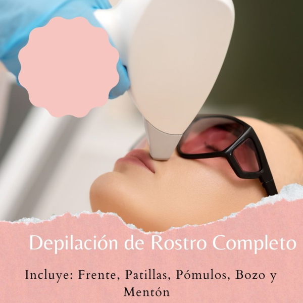 D. Trilaser Rostro Completo
