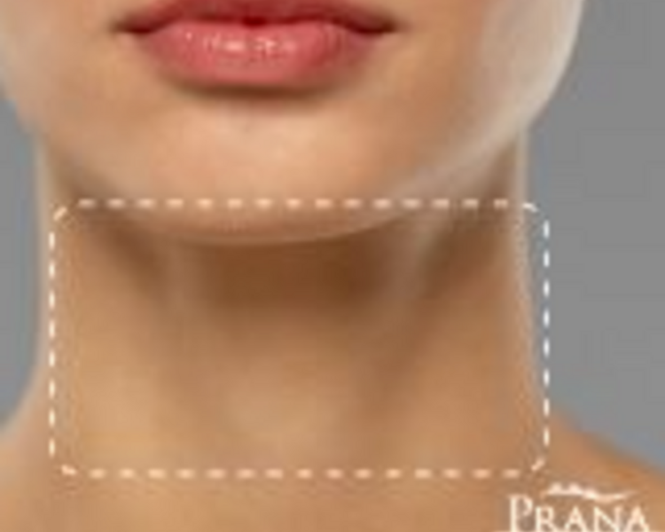 Depilación Láser Paquete Cuello