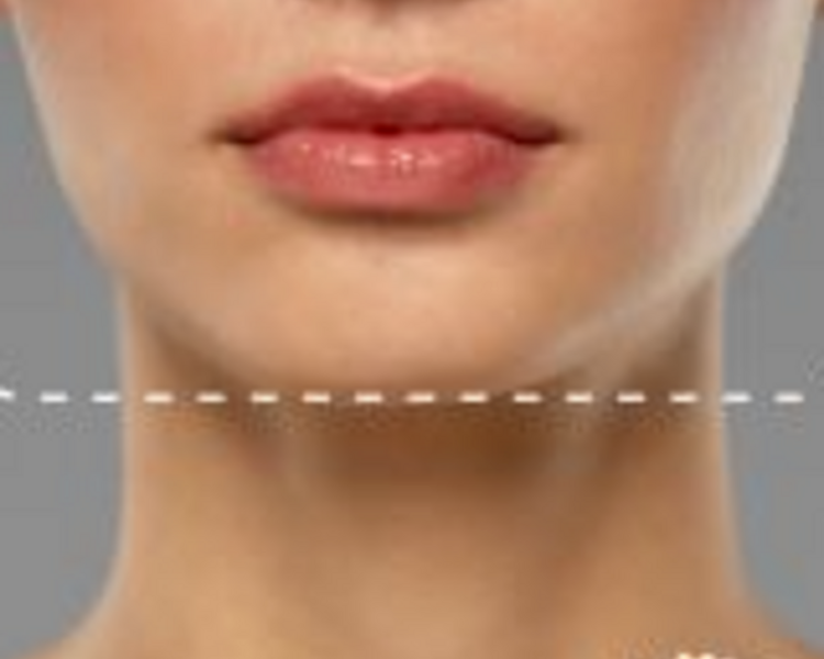 Depilación Láser Paquete Media Cara