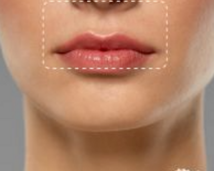 PQT-1 Depilación Láser