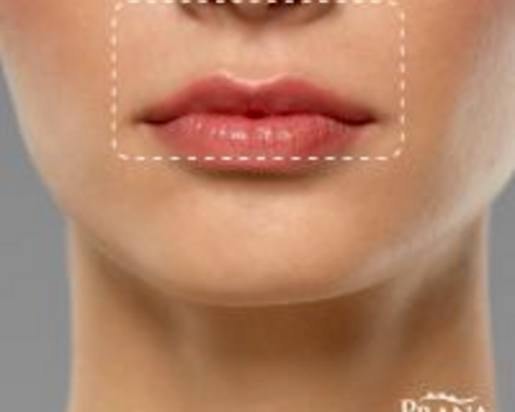 PQT-4 Depilación Láser