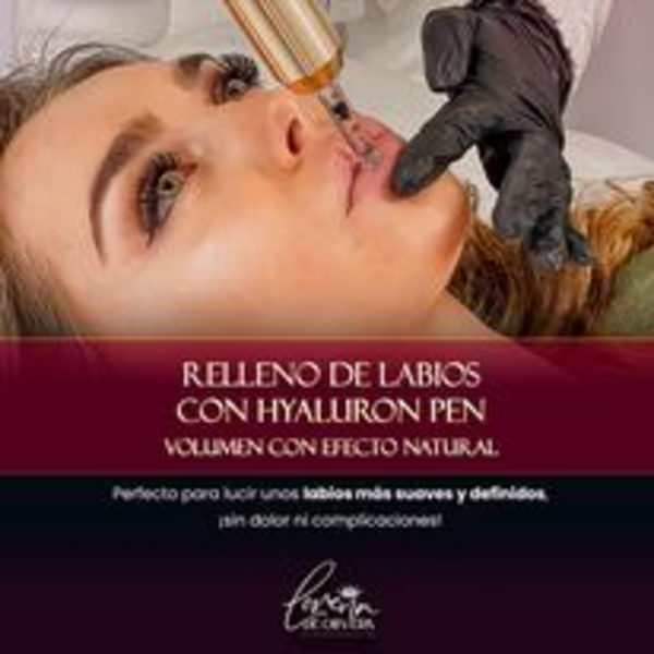 Hialuron Pen relleno de labios Con acido hialuronico 