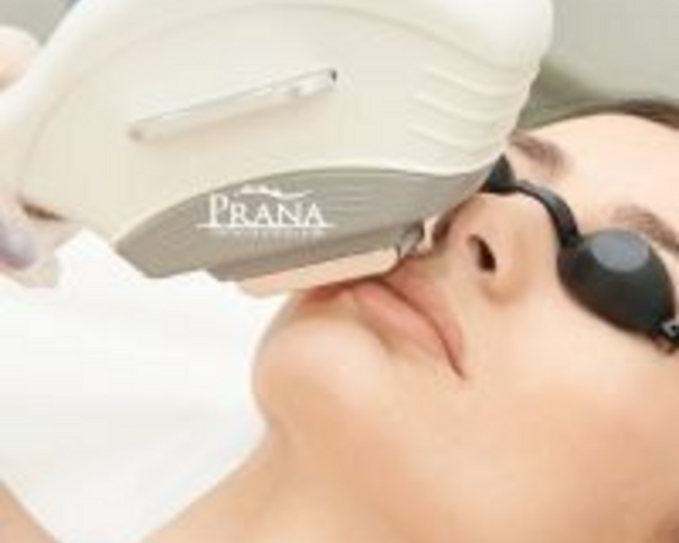 Tratamiento Facial Especializado IPL 