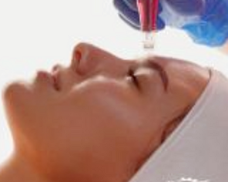 Tratamiento Facial Especializado IPL + Microneedling