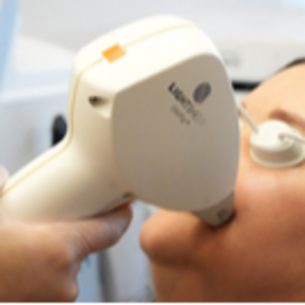 Depilación Barba Total Hombre