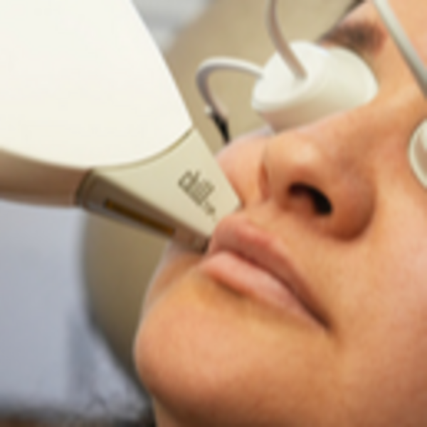 Depilación Bigote Hombre