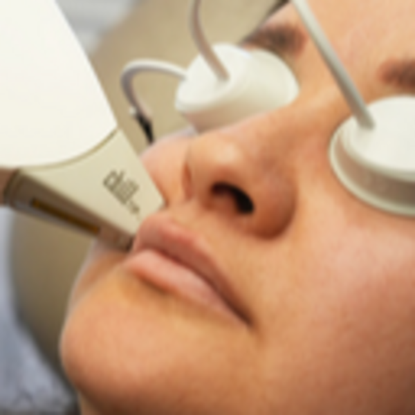 Depilación Bigote Mujer