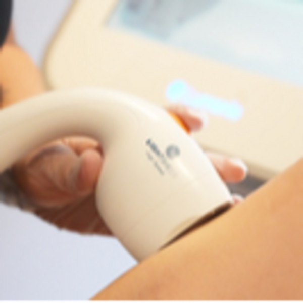 Depilación Frente Mujer