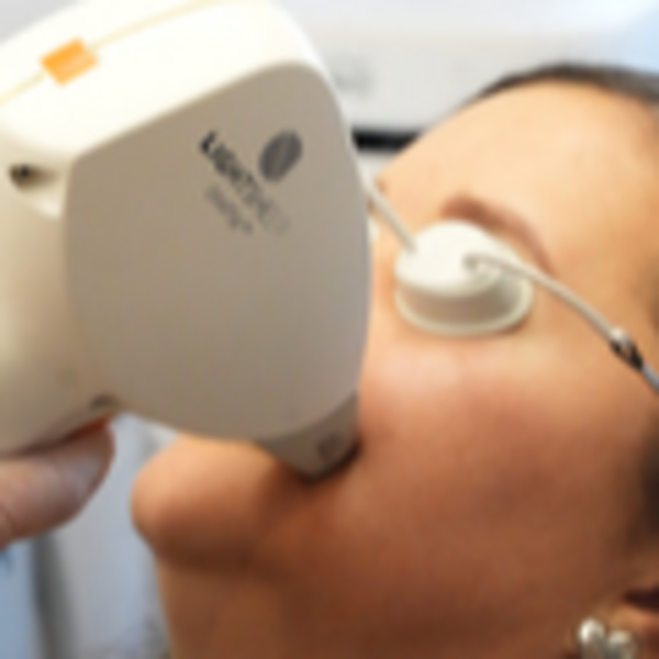 Depilación Mejillas Hombre