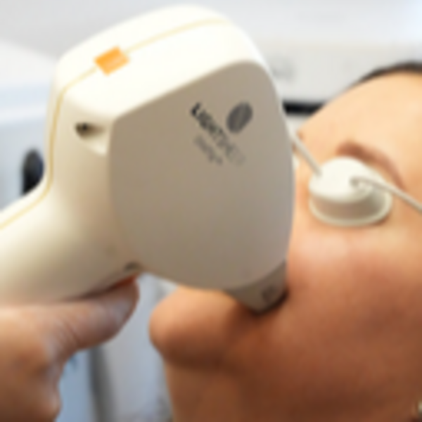 Depilación Menton Hombre