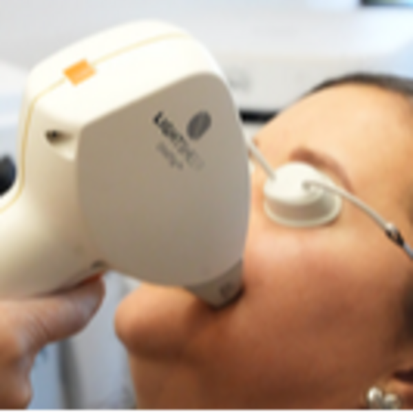 Depilación Mejillas Mujer