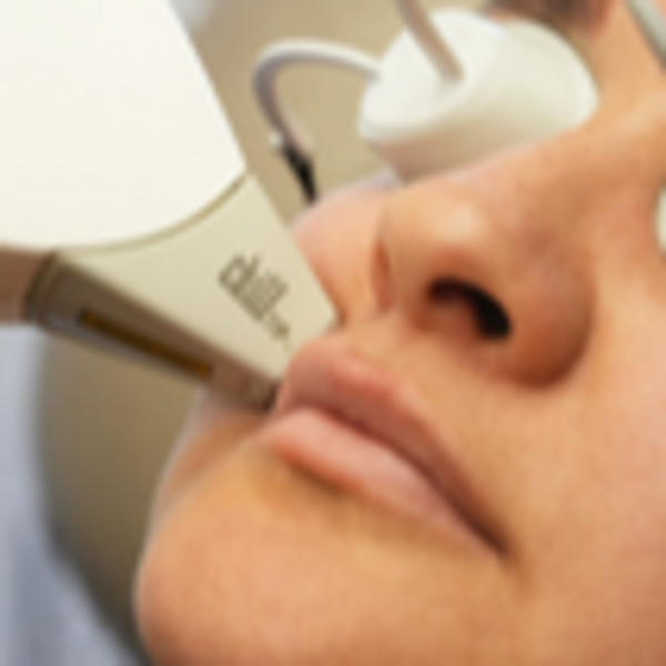 Depilación Nariz Mujer