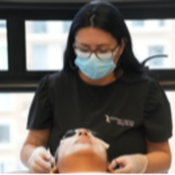 Microdermoabrasión Facial