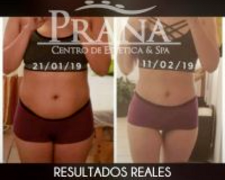 Tratamiento Corporal Post-Parto