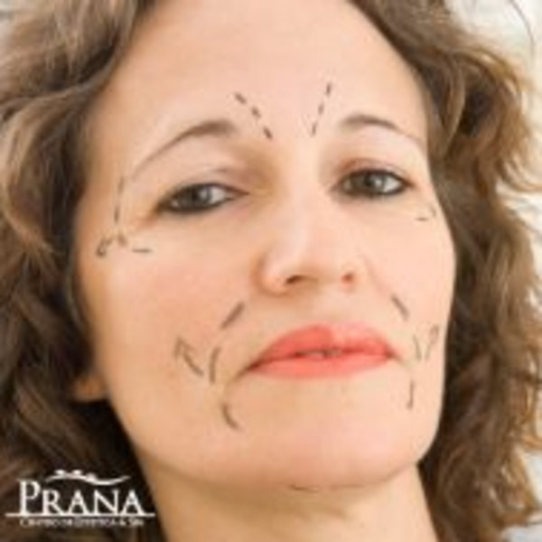 Post-operatorio Facial