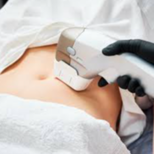 HIFU CORPORAL 12D Abdomen, cintura o espalda (2 sesiones)
