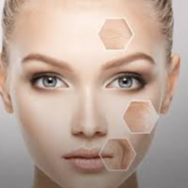 Peeling facial Melina