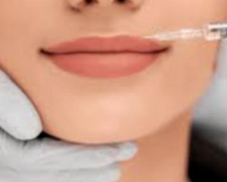 Perfilado de labios (1ml)