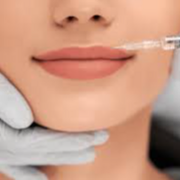 Perfilado de labios (1ml)