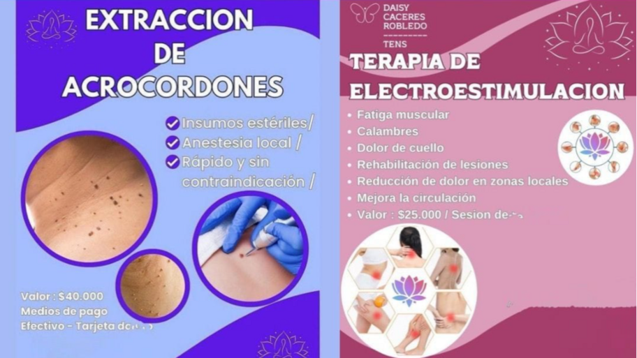 EXTRACCION DE ACROCORDONES - PROCEDIMIENTOS CLINICOS interior