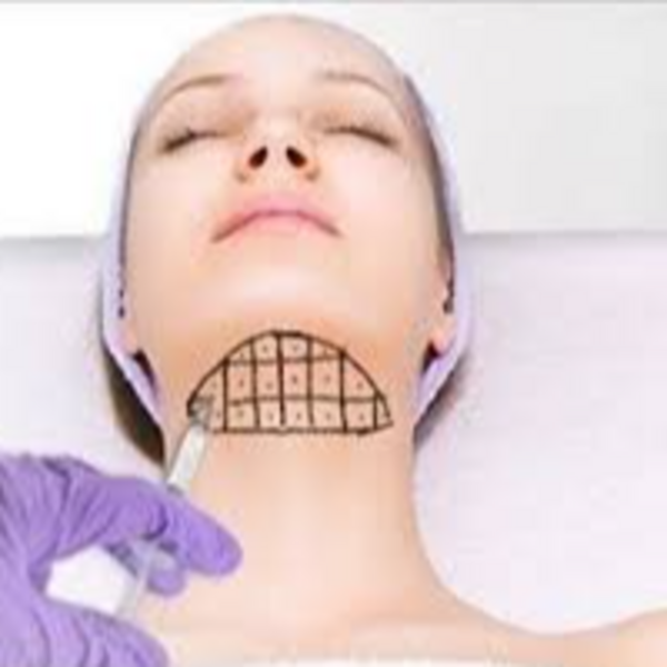 Mesoterapia lipolitica para reduccion de papada