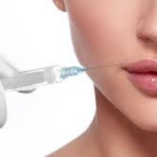 Relleno de Labios (1 ml)