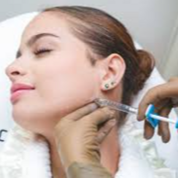 Marcaje mandibular con acido hialuronico (2 ml)