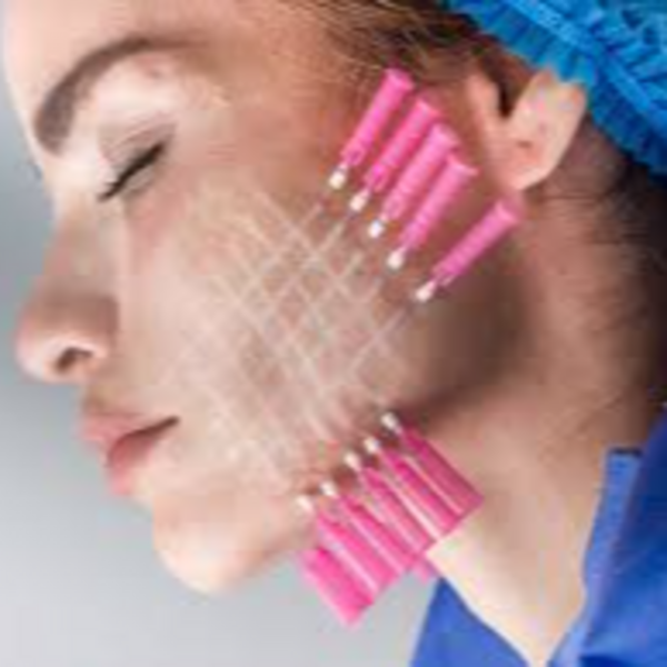 Tratamiento reafirmante facial con Hilos PDO (30 hilos)