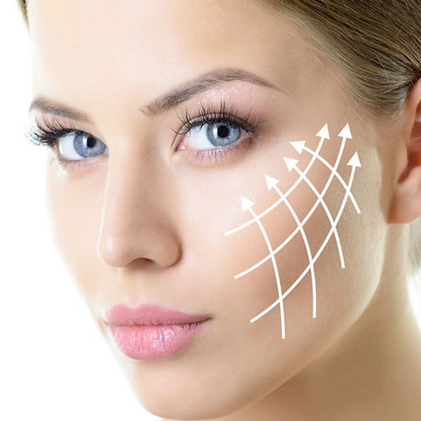 Lifting facial con Hilos tensores