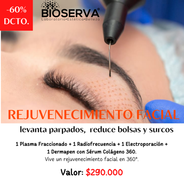 Rejuvenecimiento Facial  ( 1 PF+1 RF+ 1 EP+ 1 Dermapen)  Sesion 