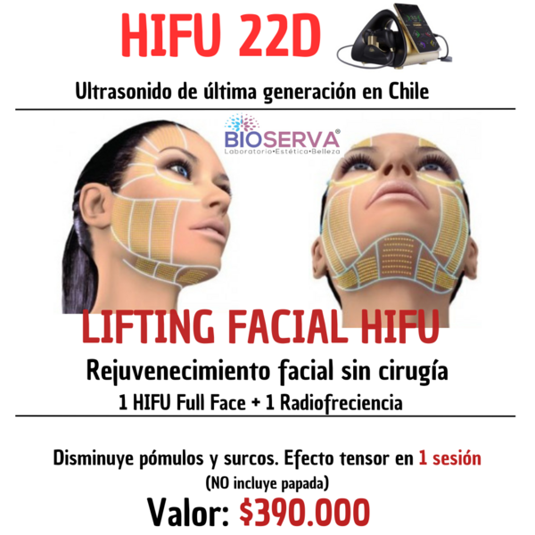 Hifu 22D   Full Face 1 sesion + RF 
