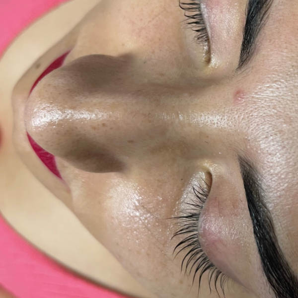 Lashlift