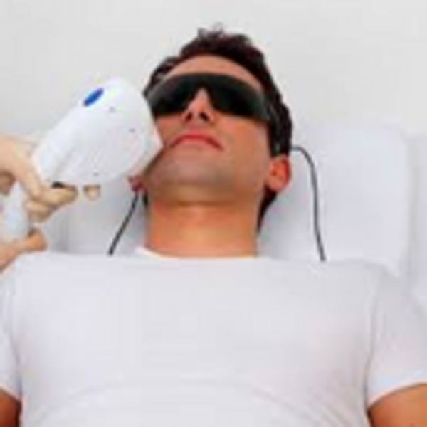 Barba Completa Masculina  6 Sesiones 