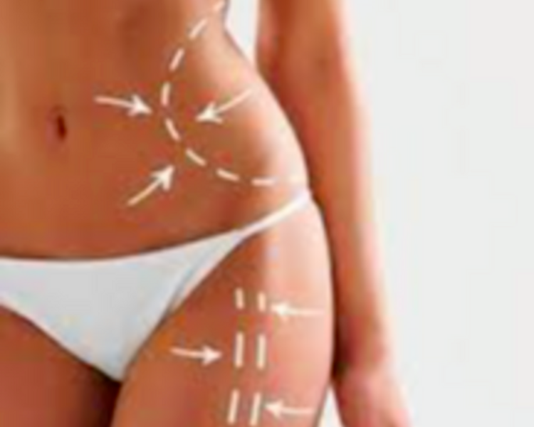 PASE MASAJE REDUCTOR x 4