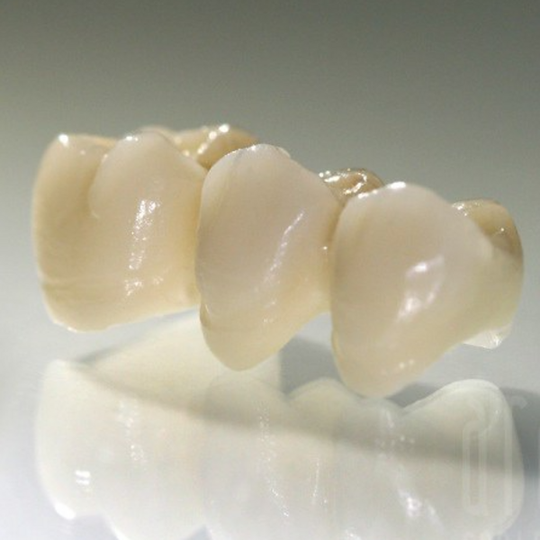 Colocacion de puente