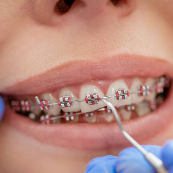 Ortodoncia