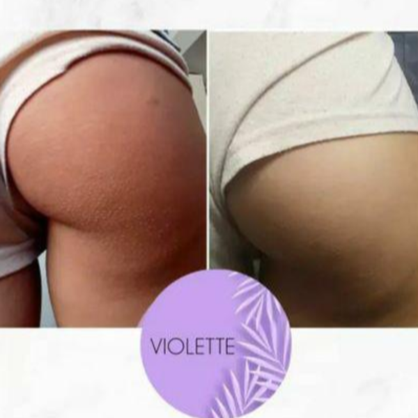 Higiene Profunda en Pompis
